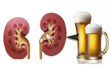 Účinek alkoholu na ledviny